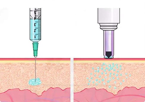 Delivers anesthetics using needle-free jet-injection technology
